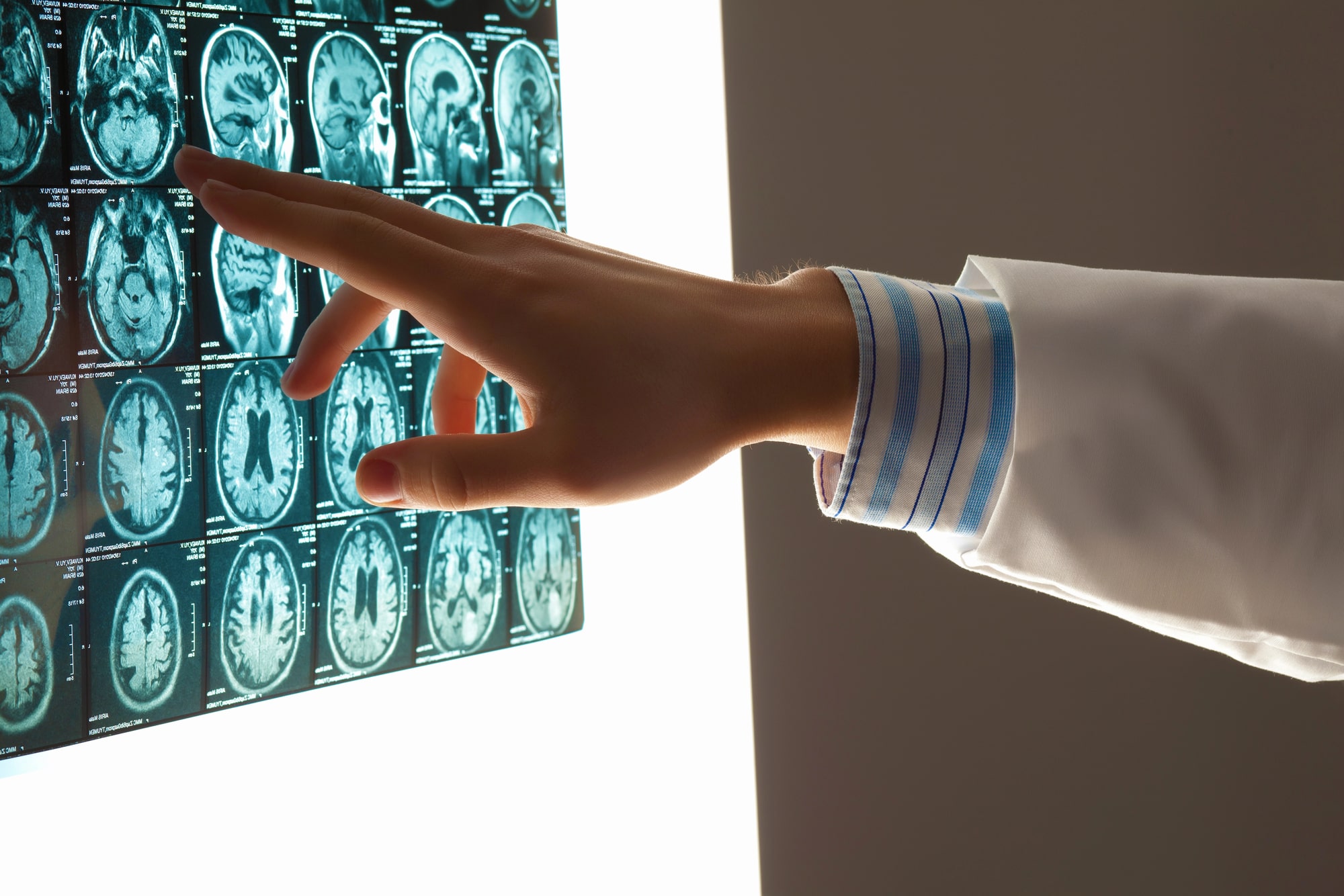 Default alt text for brain injury lawyer Statesboro, GA