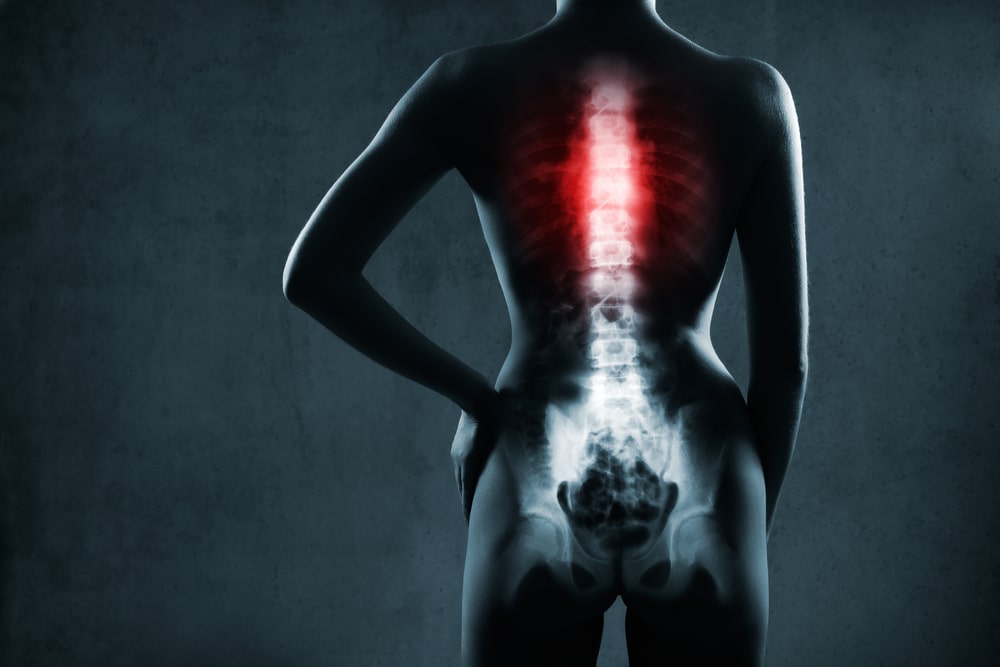 Back Injuries